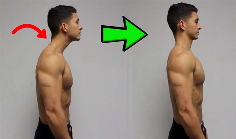 neck and head forward posture