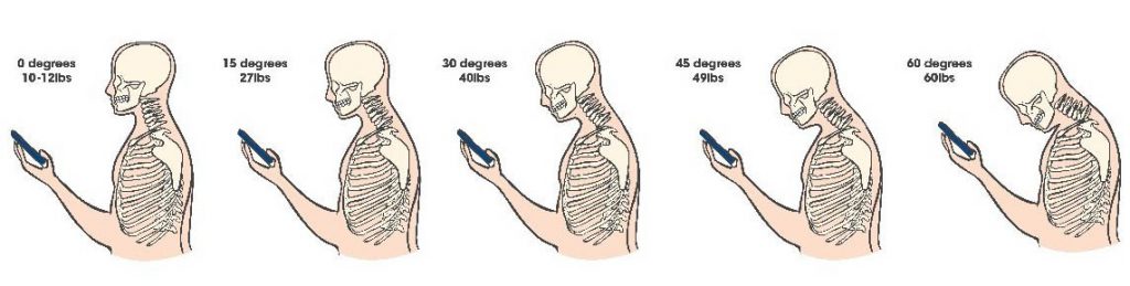 tech neck and text neck posture